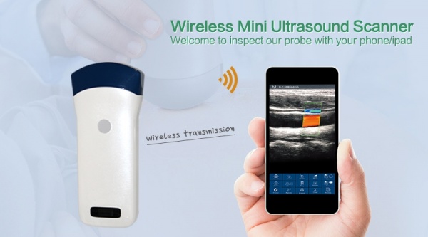 Wireless Ultrasound Probe D3.jpg