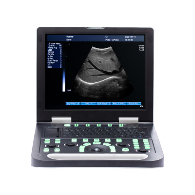 N50 - Portable Veterinary Ultrasound Machines